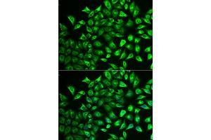 Immunofluorescence analysis of U2OS cells using MMRN1 antibody (ABIN6129053, ABIN6143926, ABIN6143927 and ABIN6222357). (Multimerin 1 抗体  (AA 949-1228))