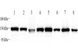 Western blot analysis of KIF5B (ABIN7074440),at dilution of 1: 4000,Lane 1: Mouse heart tissue lysate,Lane 2: Mouse brain tissue lysate,Lane 3: Mouse uterus tissue lysate,Lane 4: Mouse skin tissue lysate,Lane 5: Rat heart tissue lysate,Lane 6: Rat brain tissue lysate,Lane 7: Rat uterus tissue lysate,Lane 8: Rat skin tissue lysate (KIF5B 抗体)