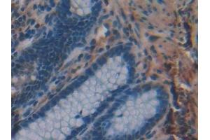 Detection of MPG in Human Rectum Tissue using Polyclonal Antibody to N-Methylpurine DNA Glycosylase (MPG) (MPG 抗体  (AA 221-296))