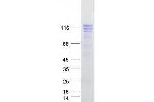 Western Blotting (WB) image for General Transcription Factor II I Repeat Domain-Containing 1 (GTF2IRD1) (Transcript Variant 1) protein (Myc-DYKDDDDK Tag) (ABIN2722322)