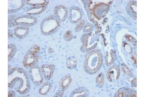 Formalin-fixed, paraffin-embedded human Prostate stained with Pan-Cytokeratin Mouse Monoclonal Antibody (PCK/3150). (KRT 抗体)
