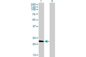 Western Blot analysis of RGS1 expression in transfected 293T cell line by RGS1 MaxPab polyclonal antibody. (RGS1 抗体  (AA 1-196))