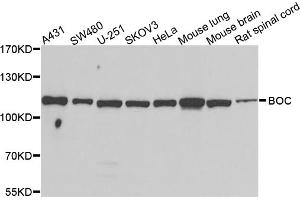 Western blot analysis of extracts of various cell lines, using BOC antibody. (BOC 抗体)