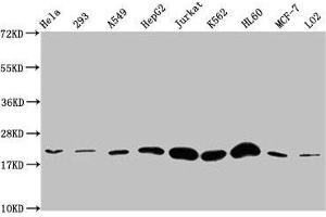 Western Blot Positive WB detected in: Hela whole cell lysate, 293 whole cell lysate, A549 whole cell lysate, HepG2 whole cell lysate, Jurkat whole cell lysate, K562 whole cell lysate, HL60 whole cell lysate, MCF-7 whole cell lysate, LO2 whole cell lysate All lanes: HIST1H1E antibody at 1:500 Secondary Goat polyclonal to rabbit IgG at 1/40000 dilution Predicted band size: 22 kDa Observed band size: 22 kDa (HIST1H1E 抗体)