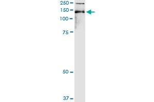 Immunoprecipitation of TIMELESS transfected lysate using anti-TIMELESS MaxPab rabbit polyclonal antibody and Protein A Magnetic Bead , and immunoblotted with TIMELESS purified MaxPab mouse polyclonal antibody (B01P) . (TIMELESS 抗体  (AA 1-1208))