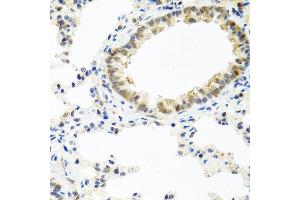 Immunohistochemistry of paraffin-embedded rat lung using BMP5 antibody at dilution of 1:100 (40x lens). (BMP5 抗体)