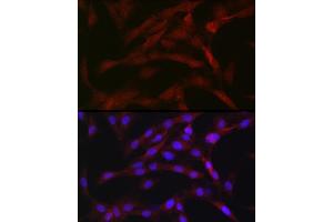 Immunofluorescence (IF) image for anti-Protein Kinase C, beta (PRKCB) (AA 1-270) antibody (ABIN6146199)