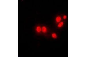 Immunofluorescent analysis of DNAJB6 staining in MCF7 cells. (DNAJB6 抗体)