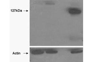 Image no. 1 for anti-Tankyrase, TRF1-Interacting Ankyrin-Related ADP-Ribose Polymerase 2 (TNKS2) (AA 800-900) antibody (ABIN401534) (TNKS2 抗体  (AA 800-900))