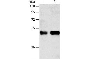 Western Blot analysis of Human liver cancer tissue and A549 cell using SERPINA5 Polyclonal Antibody at dilution of 1:750 (SERPINA5 抗体)