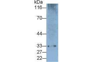 Detection of PD1 in Rat Spleen lysate using Polyclonal Antibody to Programmed Cell Death Protein 1 (PD1) (PD-1 抗体  (AA 41-132))
