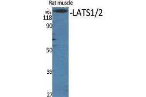 Western Blotting (WB) image for anti-LATS1,2 (Ser116) antibody (ABIN3180713) (LATS1,2 (Ser116) 抗体)