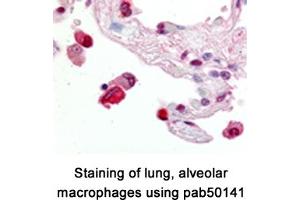 Image no. 1 for anti-ATP-Binding Cassette, Sub-Family G (WHITE), Member 1 (ABCG1) (AA 300-400), (Internal Region) antibody (ABIN363450) (ABCG1 抗体  (Internal Region))