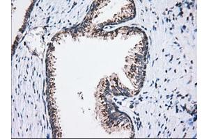 Immunohistochemical staining of paraffin-embedded Human liver tissue using anti-MOBKL1A mouse monoclonal antibody. (MOBKL1A 抗体)