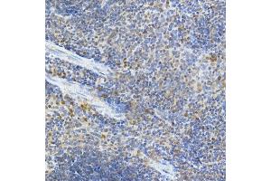 Immunohistochemistry of paraffin-embedded mouse spleen using IFIH1 Rabbit pAb (ABIN6131879, ABIN6142174, ABIN6142175 and ABIN6217724) at dilution of 1:50 (40x lens).