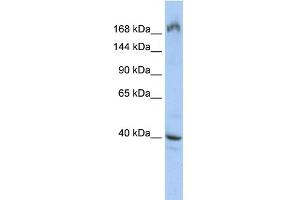 WB Suggested Anti-EIF4G1 Antibody Titration:  0. (EIF4G1 抗体  (Middle Region))