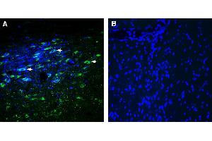 Expression of Glycine Receptor alpha 3 in rat substantia nigra pars compacta (SNC). (GLRA3 抗体  (AA 355-368))