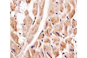 Immunohistochemistry (IHC) image for anti-PTEN Induced Putative Kinase 1 (PINK1) antibody (ABIN3028956)