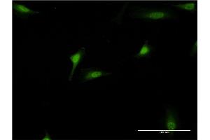 Immunofluorescence of monoclonal antibody to DEAF1 on HeLa cell. (DEAF1 抗体  (AA 133-222))