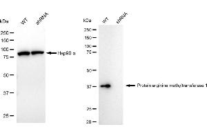 Western blotting analysis using protein arginine methyltransferase 1 antibody (ABIN7799969).