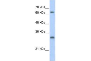 Western Blotting (WB) image for anti-Ubiquitin Specific Peptidase 39 (USP39) antibody (ABIN2461797) (USP39 抗体)