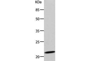 Western Blot analysis of 293T cell using DUT Polyclonal Antibody at dilution of 1:500 (Deoxyuridine Triphosphatase (DUT) 抗体)