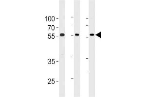 Western blot analysis in 293,A549,Ramos cell line lysates (35ug/lane). (TRIM6 抗体  (N-Term))