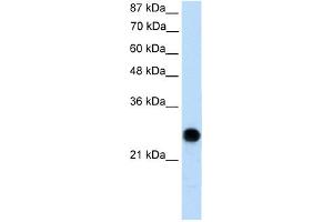 Western Blotting (WB) image for anti-Voltage-Dependent Anion Channel 2 (VDAC2) (N-Term) antibody (ABIN2776154)