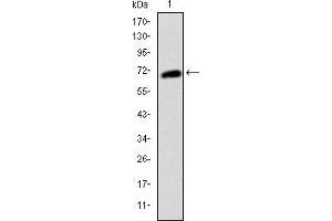 Western blot analysis using KIT mAb against human KIT (AA: 805-976) recombinant protein. (KIT 抗体)