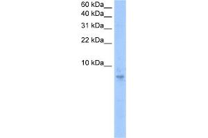 WB Suggested Anti-SEPT6(septin 6) Antibody Titration:  0. (Septin 6 抗体  (N-Term))