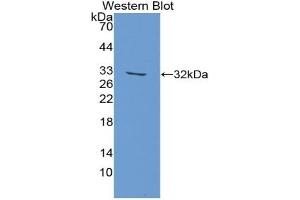 Detection of Recombinant FASN, Rat using Polyclonal Antibody to Fatty Acid Synthase (FASN) (Fatty Acid Synthase 抗体  (AA 2243-2505))