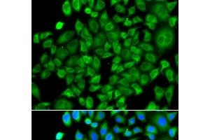 Immunofluorescence analysis of A549 cells using NAA50 Polyclonal Antibody (NAA50 抗体)