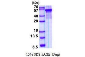 Figure annotation denotes ug of protein loaded and % gel used. (ARSG 蛋白)