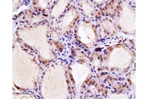 Immunohistochemistry (Paraffin-embedded Sections) (IHC (p)) image for anti-Solute Carrier Family 5 (Sodium/iodide Cotransporter), Member 5 (SLC5A5) (AA 525-618) antibody (ABIN668751)