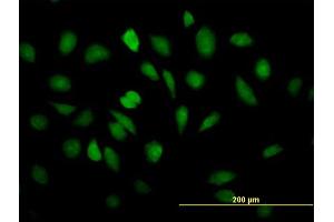 Immunofluorescence of purified MaxPab antibody to EEF1E1 on HeLa cell. (EEF1E1 抗体  (AA 1-174))
