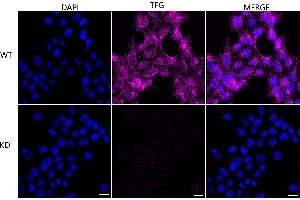 Immunocytochemical staining of HeLa cells using TFG antibody (ABIN7800647), 1:1,000), Top panel: wild-type (WT), Bottom panal: TFG shRNA knockdown (KD).