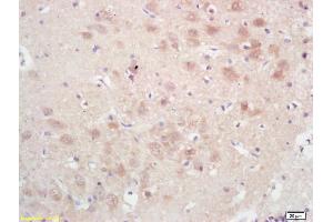 Formalin-fixed and paraffin embedded rat brain labeled with Rabbit Anti GPAM Polyclonal Antibody, Unconjugated (ABIN709121) at 1:200 followed by conjugation to the secondary antibody and DAB staining (GPAM 抗体  (AA 611-710))
