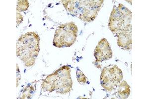 Immunohistochemistry of paraffin-embedded Human stomach using STK3 Polyclonal Antibody at dilution of 1:100 (40x lens). (STK3 抗体)