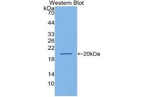 Western Blotting (WB) image for anti-Endothelial Cell-Specific Molecule 1 (ESM1) (AA 22-184) antibody (ABIN1175699) (ESM1 抗体  (AA 22-184))