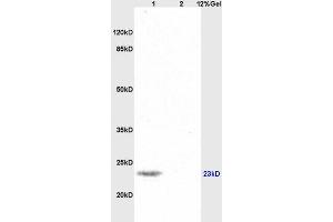 Lane 1: mouse brain lysates Lane 2: human colon carcinoma lysates probed with Anti SNAP25 Polyclonal Antibody, Unconjugated (ABIN738111) at 1:200 in 4 °C. (SNAP25 抗体  (AA 166-206))