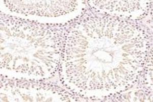 Immunohistochemistry (Paraffin-embedded Sections) (IHC (p)) image for anti-Zinc Finger Protein 746 (ZNF746) antibody (ABIN7076272)