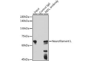 Immunoprecipitation (IP) image for anti-Neurofilament, Light Polypeptide (NEFL) antibody (ABIN7268867)