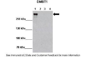 Lanes:   Lane 1: 2ug MCF7-DMBT1+Dox Lane 2: 2ug MCF7-DMBT1 -Dox Lane 3: 2ug MCF7-Ctrl+Dox Lane 4: 2ug MCF7-DMBT1 -Dox  Primary Antibody Dilution:    1:5000  Secondary Antibody:   Anti-rabbit HRP  Secondary Antibody Dilution:    1:10,000  Gene Name:   DMBT1  Submitted by:   Matthias Rauen, Lundbeckfonden Center of Excellence NanoCAN, University of Southern Denmark (DMBT1 抗体  (N-Term))
