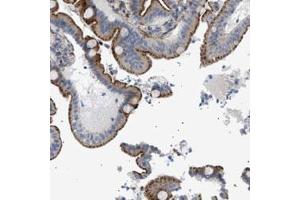 Immunohistochemical staining (Formalin-fixed paraffin-embedded sections) of human duodenum with SFXN5 polyclonal antibody  shows cytoplasmic and membranous positivity in glandular cells at 1:50-1:200 dilution. (Sideroflexin 5 抗体)