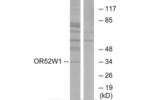 Western blot analysis of extracts from HeLa cells, using OR52W1 antibody. (OR52W1 抗体  (C-Term))