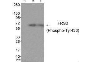 Western blot analysis of extracts from HuvEc cells (Lane 2) and JK cells (Lane 3), using FRS2 (Phospho-Tyr436) Antibody. (FRS2 抗体  (pTyr436))