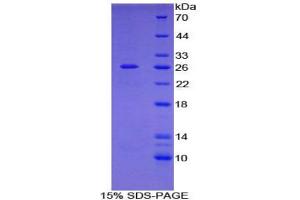 SDS-PAGE analysis of Human Filamin C gamma Protein. (FLNC 蛋白)