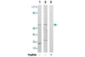 Western blot analysis of extracts from LoVo cells (Lane 1 and lane 3) and HUVEC cells (Lane 2), using CYP39A1 polyclonal antibody . (CYP39A1 抗体)