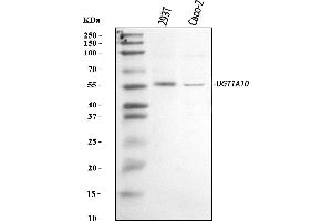 Western blot analysis of UGT1A10 using anti-UGT1A10 antibody (ABIN7603103).