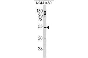 Western blot analysis of BLNK Antibody in NCI-H460 cell line lysates (35ug/lane) (B-Cell Linker 抗体  (AA 150-178))